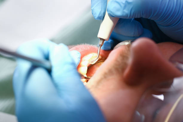 Best Dentist for Tooth Abscess  in Marlton, MD