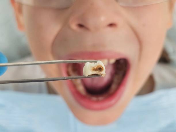 Best Tooth Pain Emergency Relief  in Marlton, MD